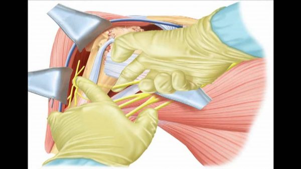 Video: Equinoxe Shoulder Managing the Axillary Nerve Animation | www ...