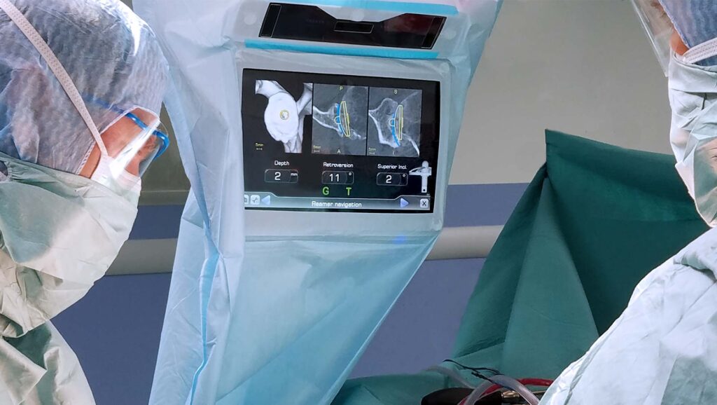 ExactechGPS Guided Personalized Surgery. ExactechGPS® is a compact, surgeon controlled, computer-assisted surgical technology that delivers reproducibility in total joint arthroplasty.