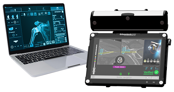 Equinoxe Planning App and ExactechGPS Shoulder connect the preoperative plan with real-time intraoperative instrument guidance.